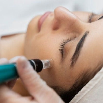 Micro needling + Vitamins